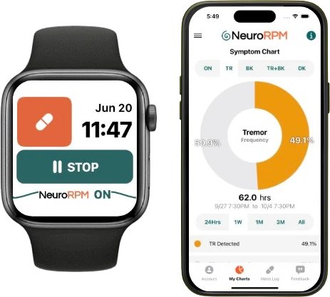 NeuroRPM on an Apple Watch and the NeuroRPM phone app showing a tremor symptom chart